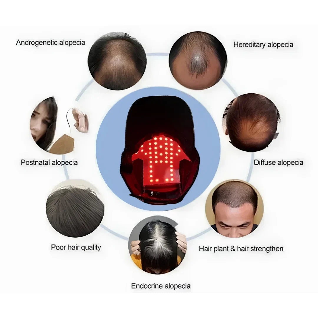 Wireless Red Light Therapy Hat